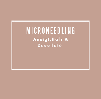 Behandlinger Microneedling Ansigt, Hals & Decolleté
